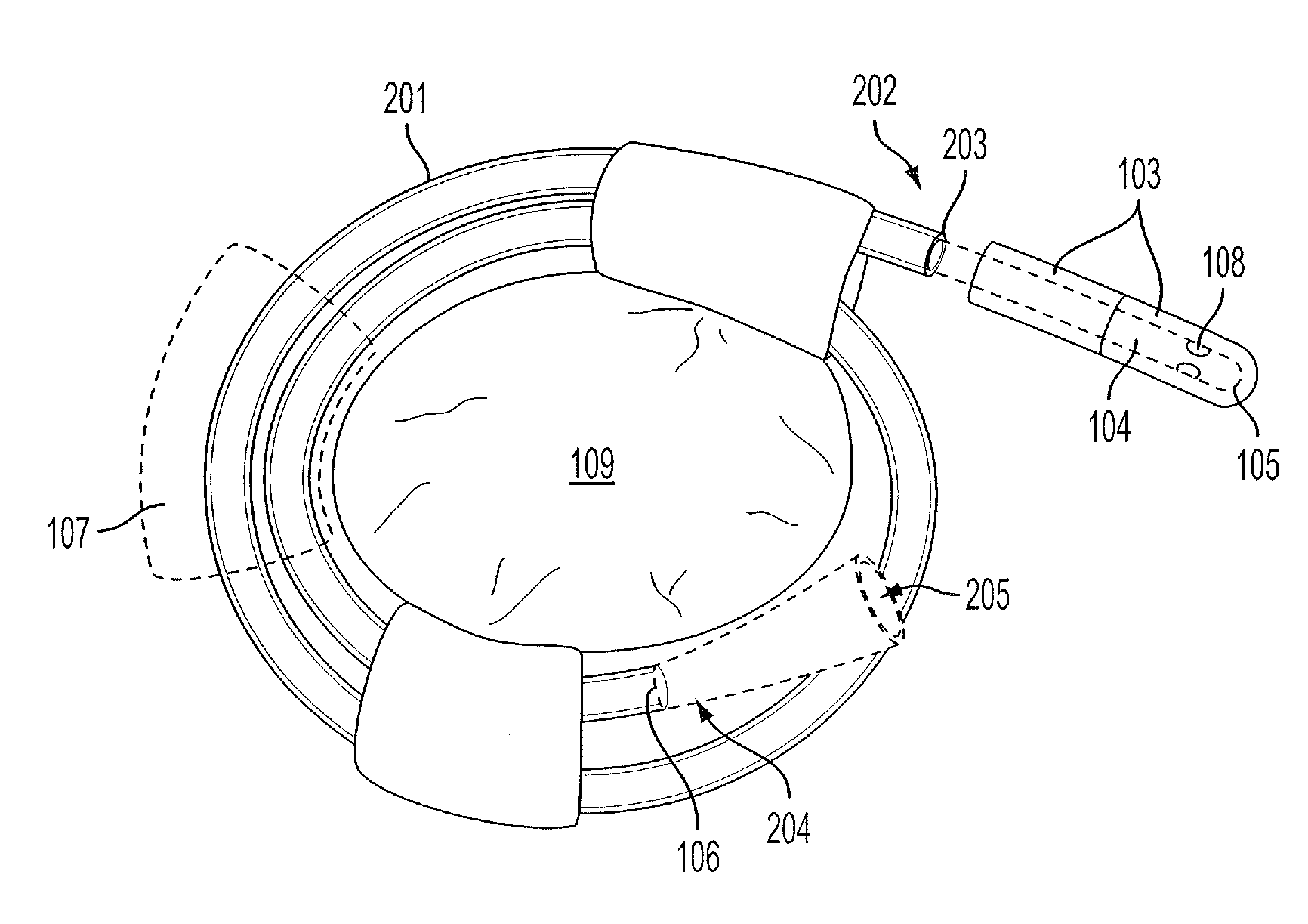 Compact catheter assembly