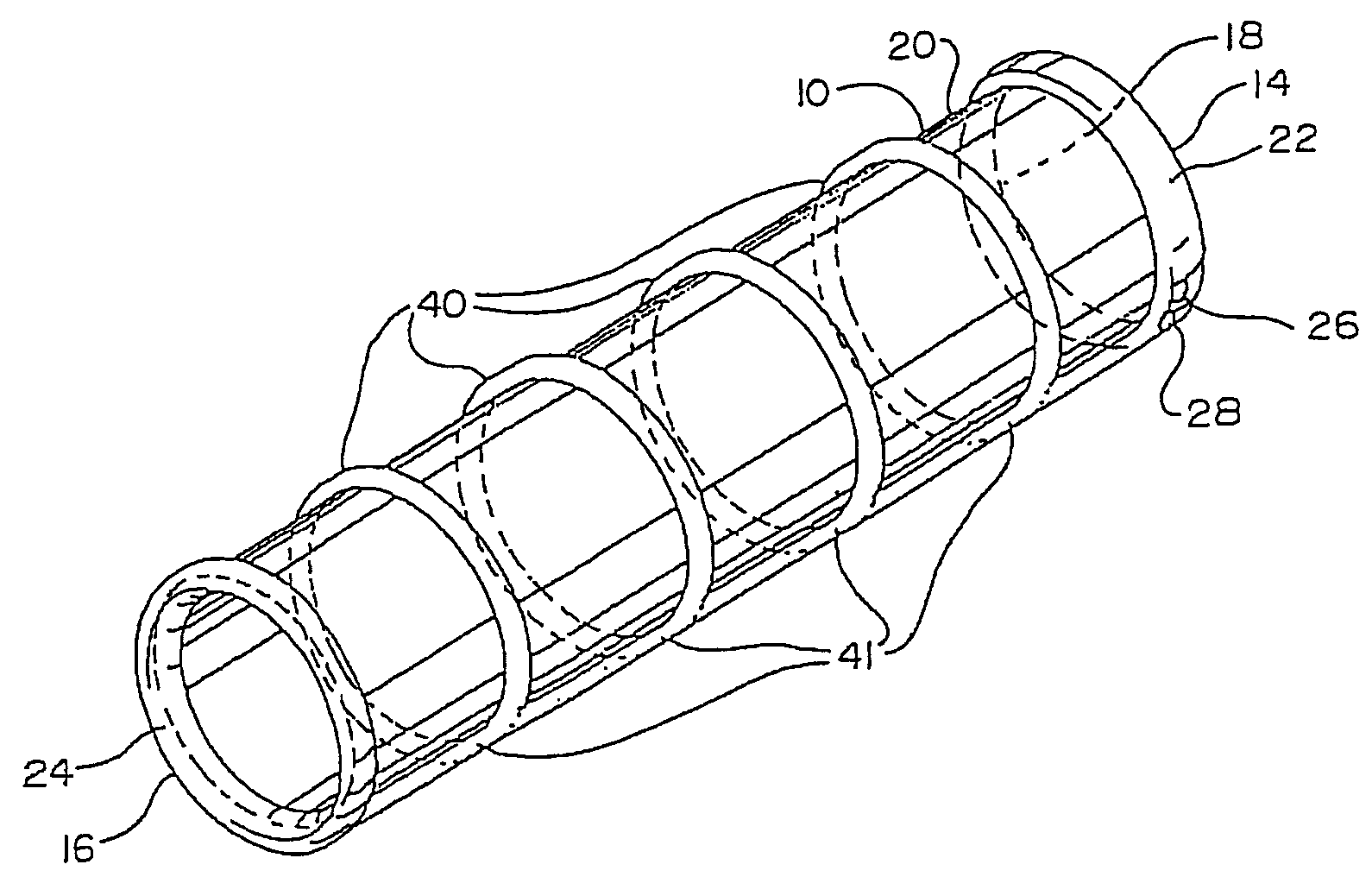 Endovascular apparatus