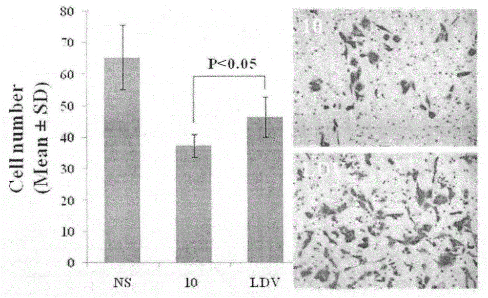 Leu-Asp-Val modified curcumin, preparation method, biological activity and application thereof