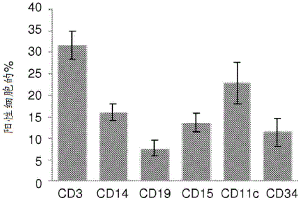 Cellular markers for diagnosis of alzheimer's disease and for alzheimer's disease progression