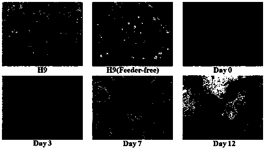 DNA methylation biomarkers for evaluating cardiac muscle cell damage and application thereof