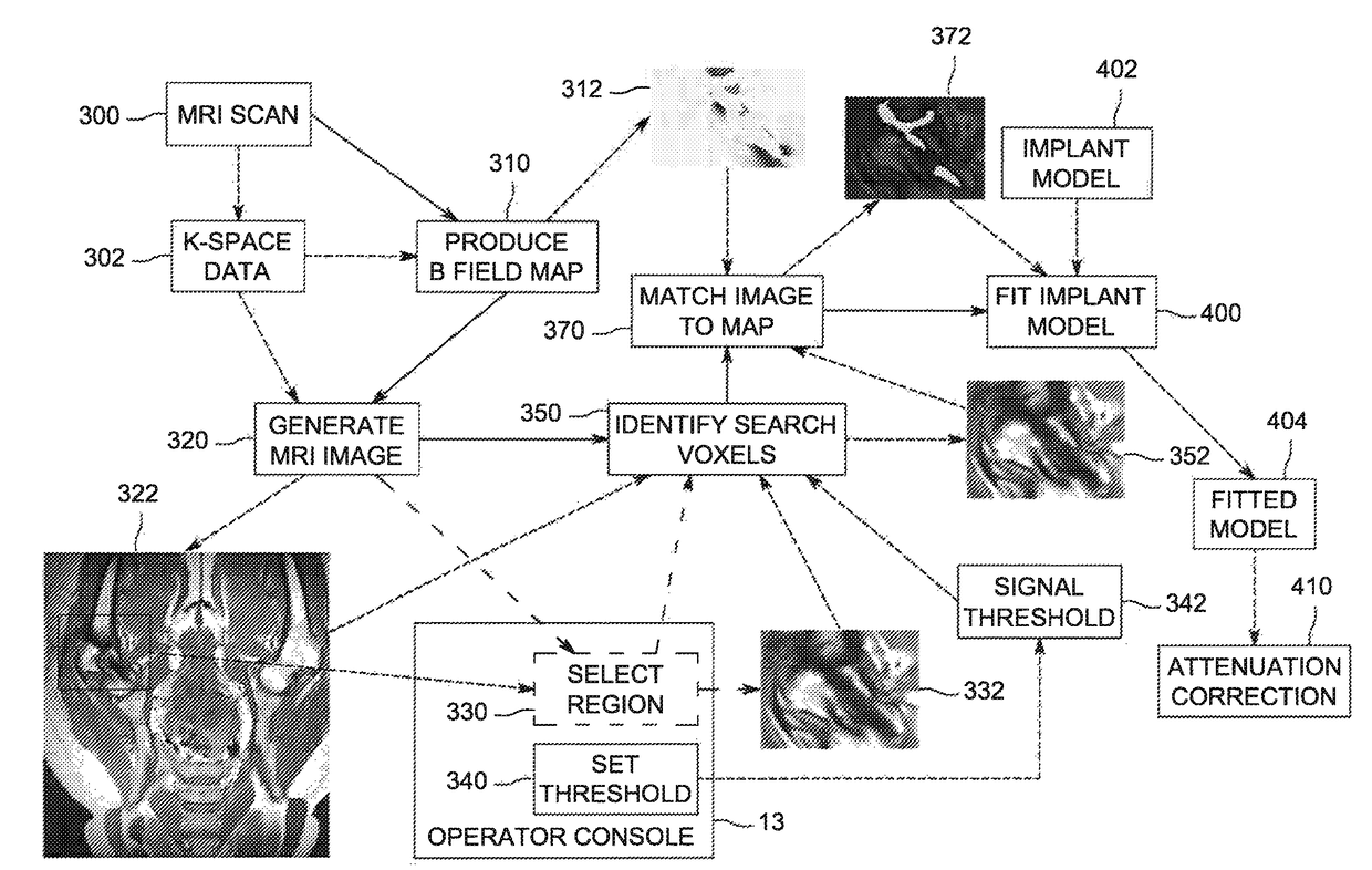 Method, apparatus, and article for pet attenuation correction utilizing MRI