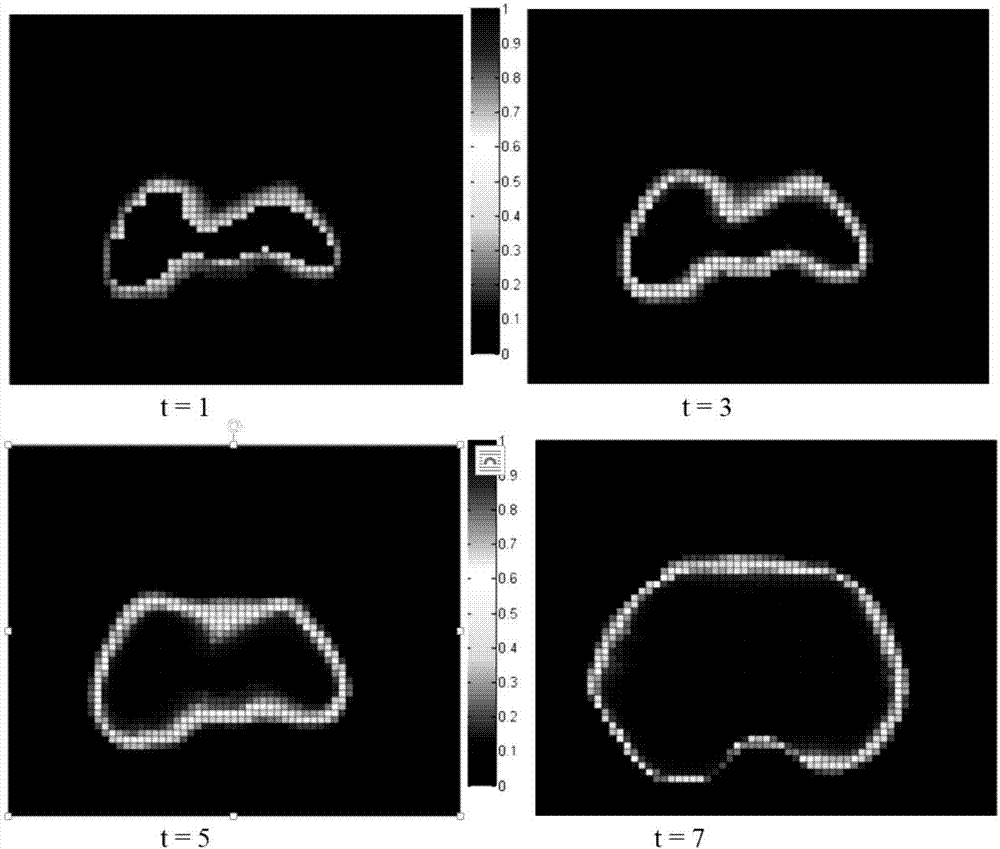 Tumor clinical target volume invasiveness probability calculating method based on hidden Markov model