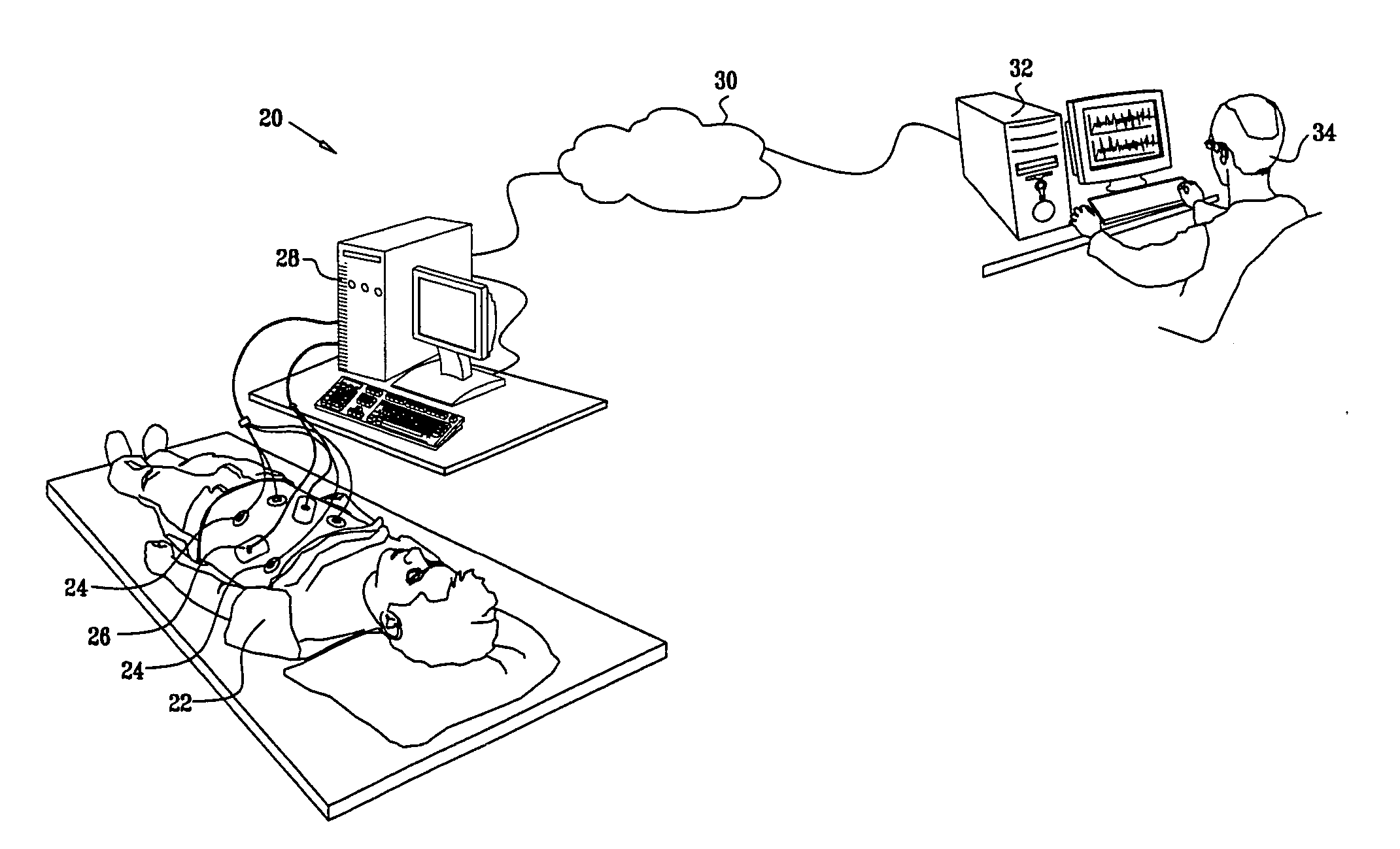 Sleep staging based on cardio-respiratory signals