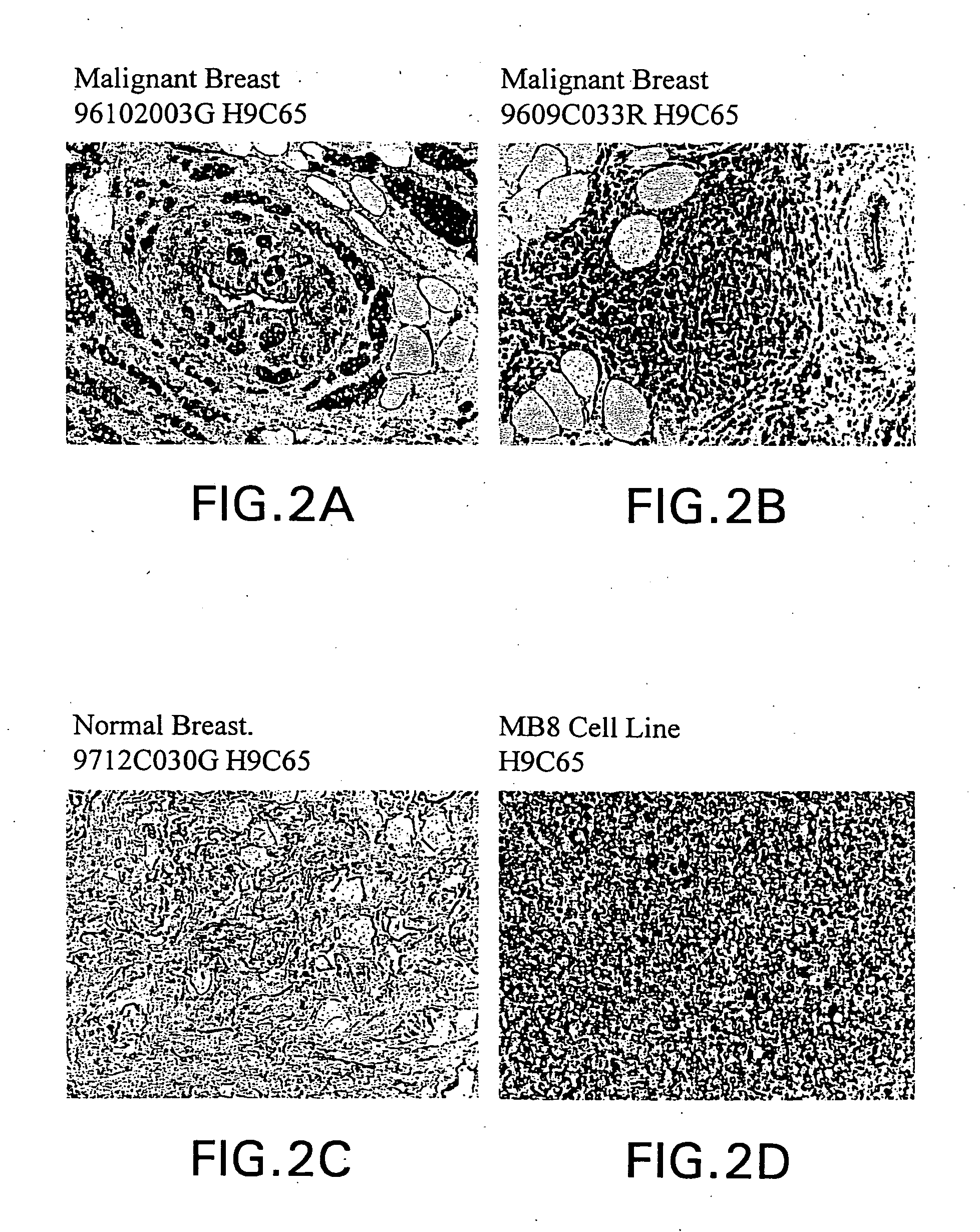 Reagents and methods useful for detecting diseases of the breast