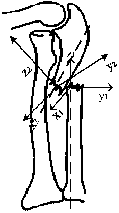 Computer aided design method for fracture reduction