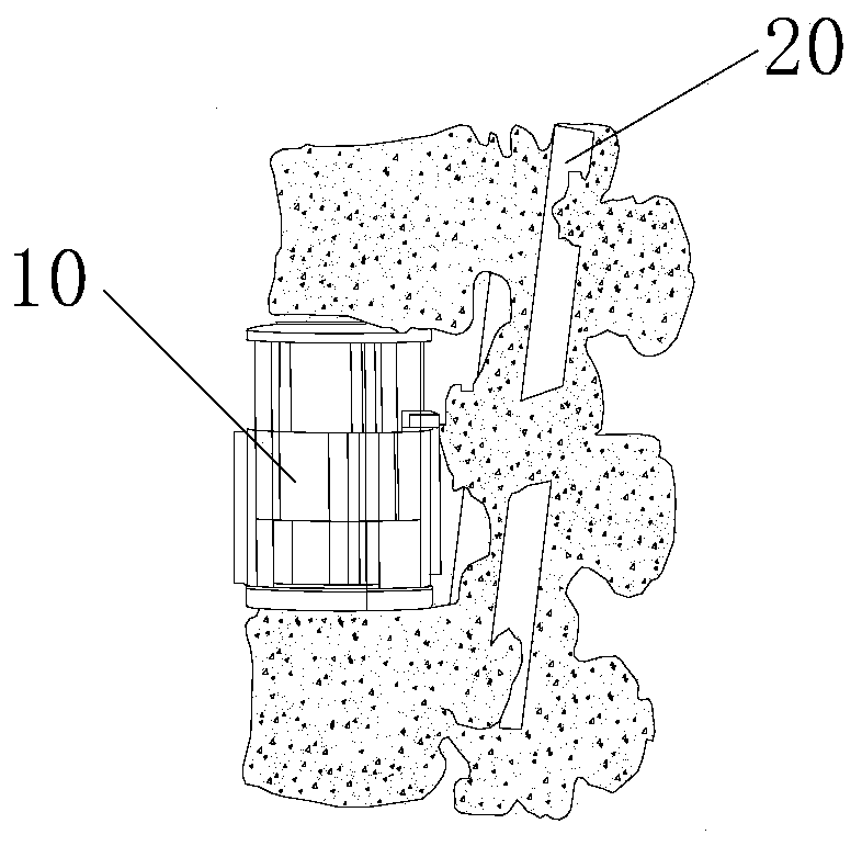 Centrum extension device