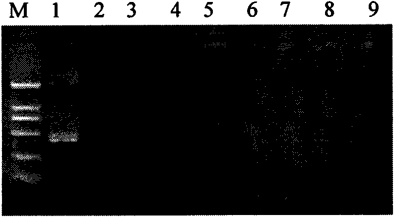 Kit for identifying and diagnosing different species of bovine theileria and method thereof