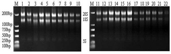 Primers for screening internal reference genes under low temperature stress in lotus mist and their application