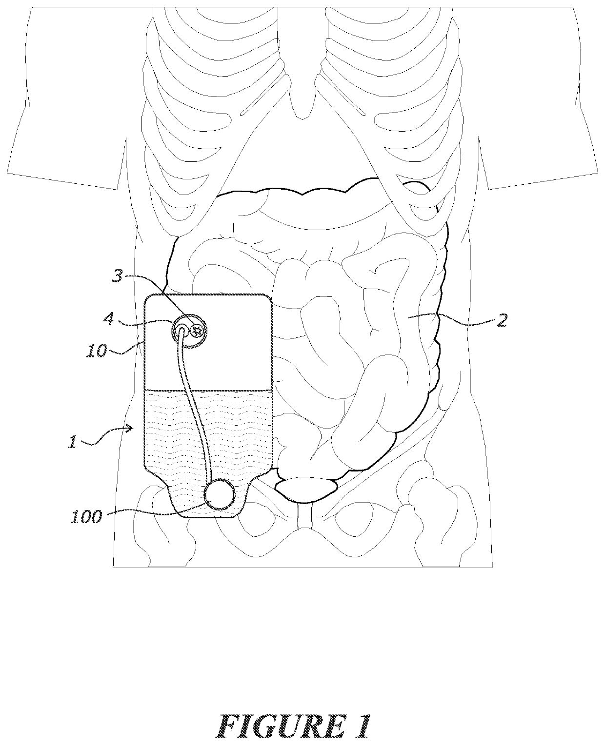 Nutrient recycling device