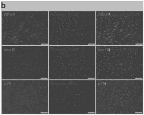 Application of miR containing 5'- terminal specific seed base sequence, improved Schwann cell and applications thereof