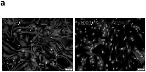 Application of miR containing 5'- terminal specific seed base sequence, improved Schwann cell and applications thereof