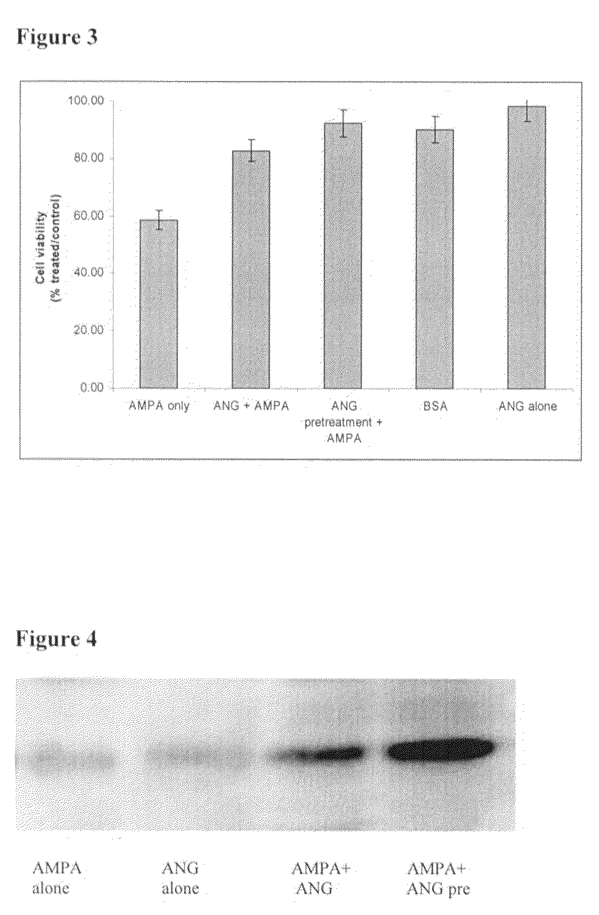 Treatment of ALS and variants thereof consisting of primary lateral sclerosis (PLS) or spinal muscular atrophy (SMA)