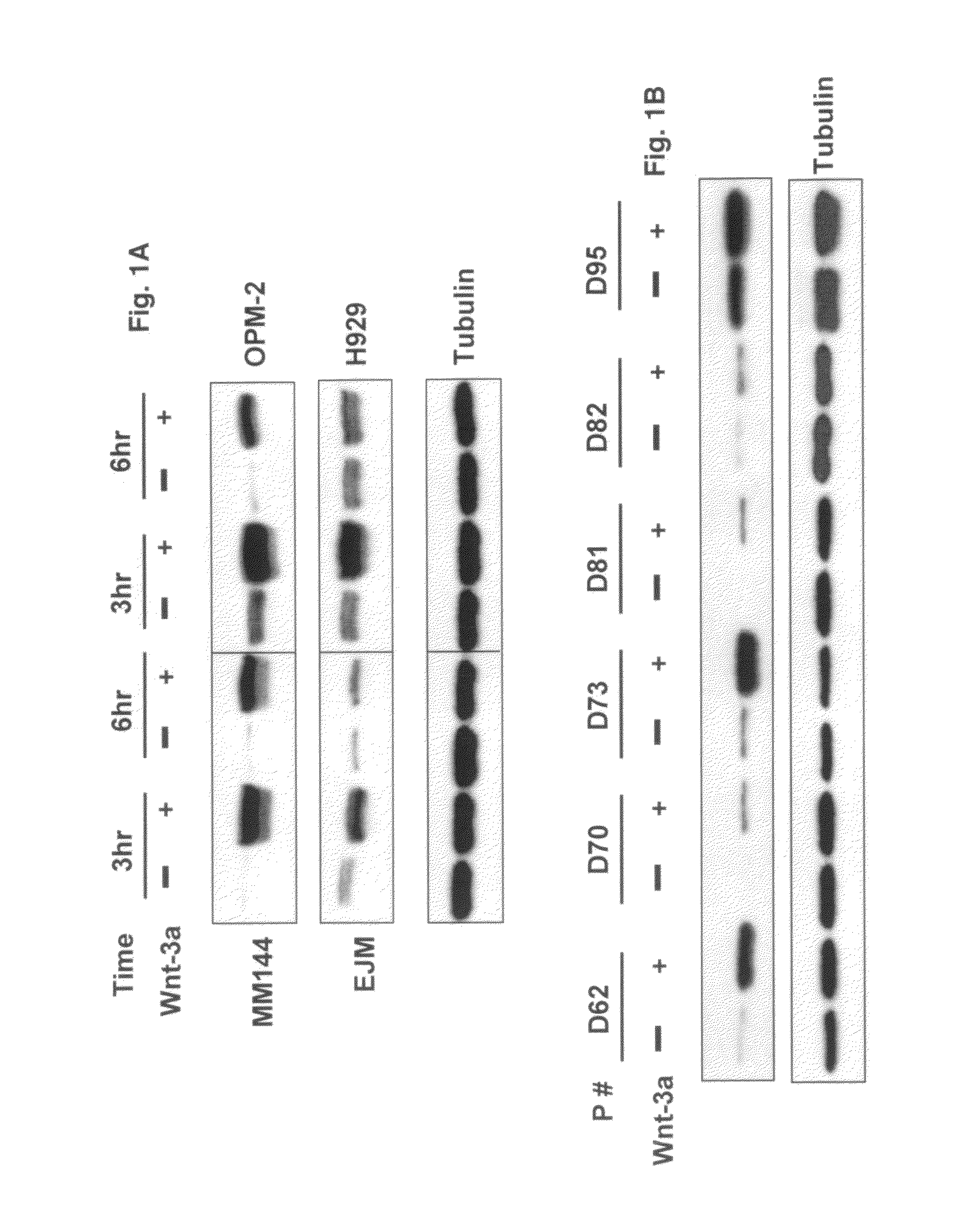 Overexpression of Wnt ligands and treatment of lytic bone diseases