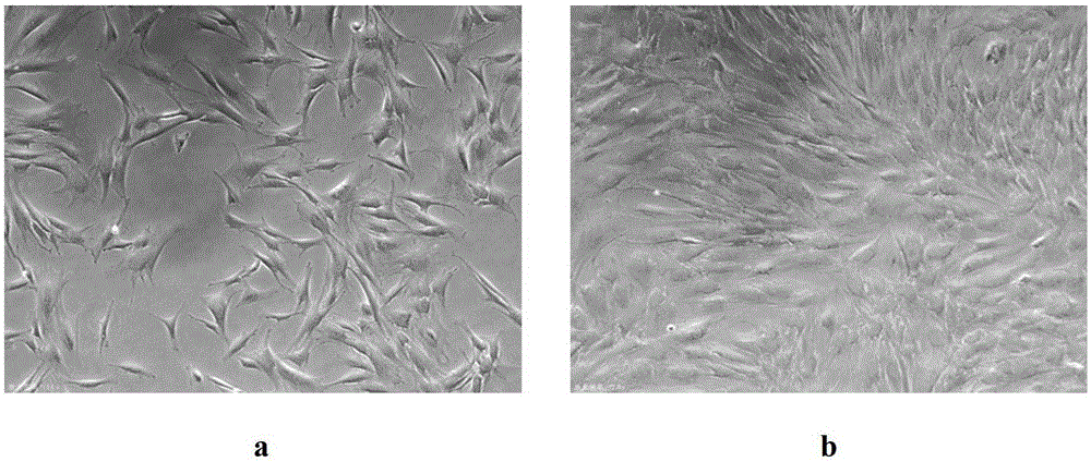 Cryopreservation resuscitation solution for sweat gland-like cells and cryopreservation and resuscitation method for maintaining cell activity