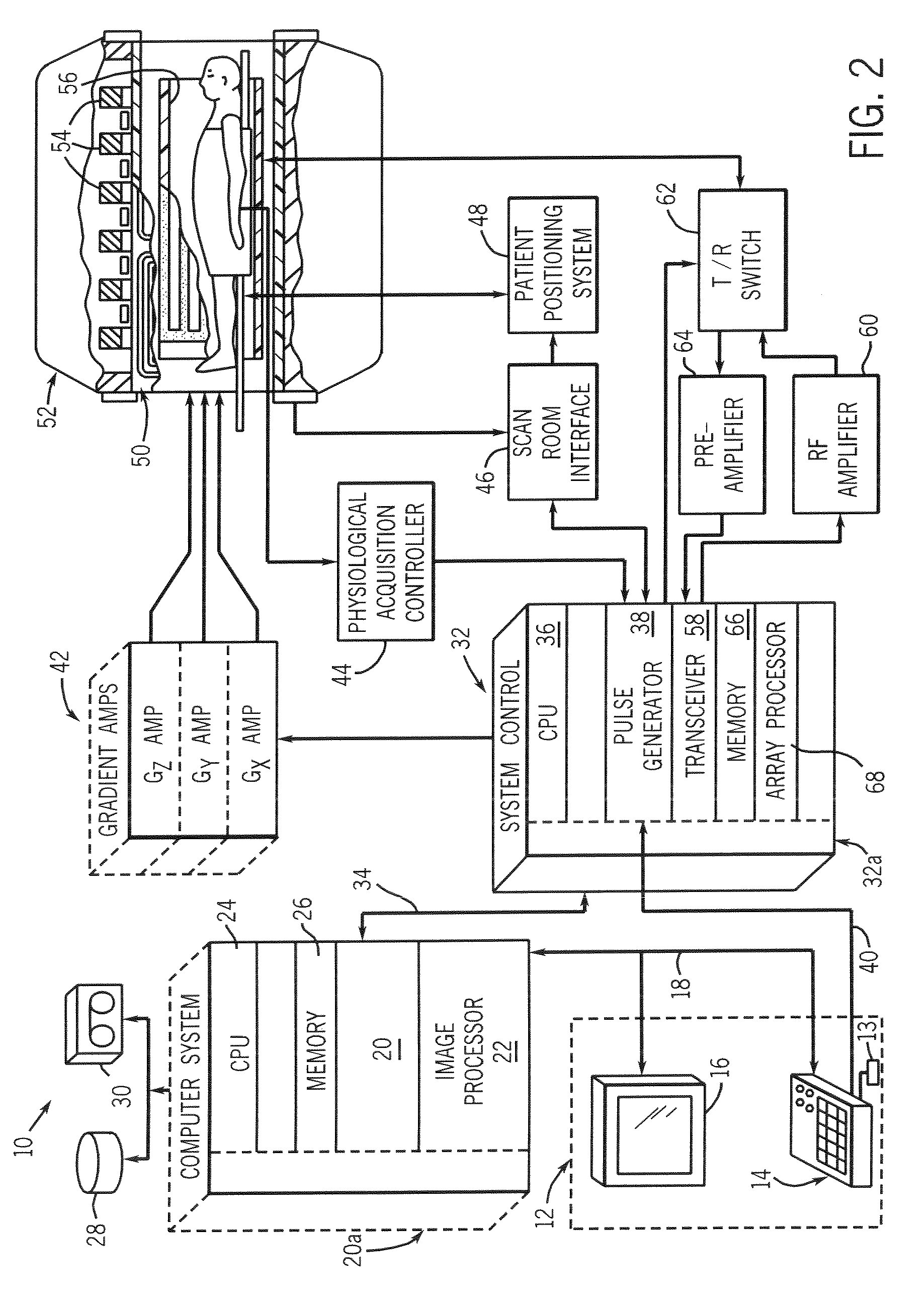 Method of designing a shim coil to reduce field settling time