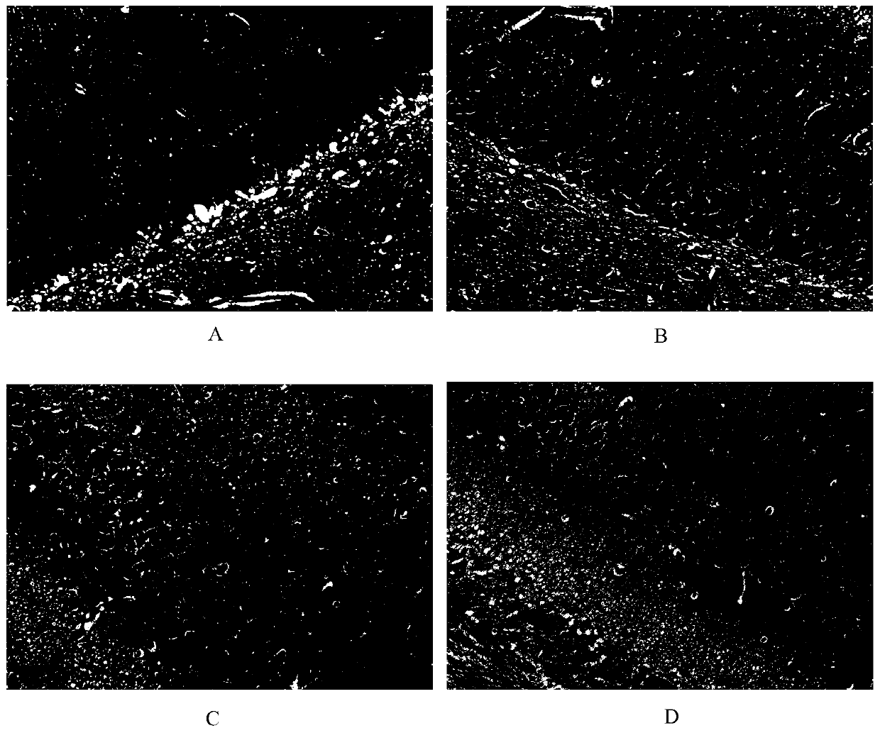 Lactobacillus plantarum dp189 and its application