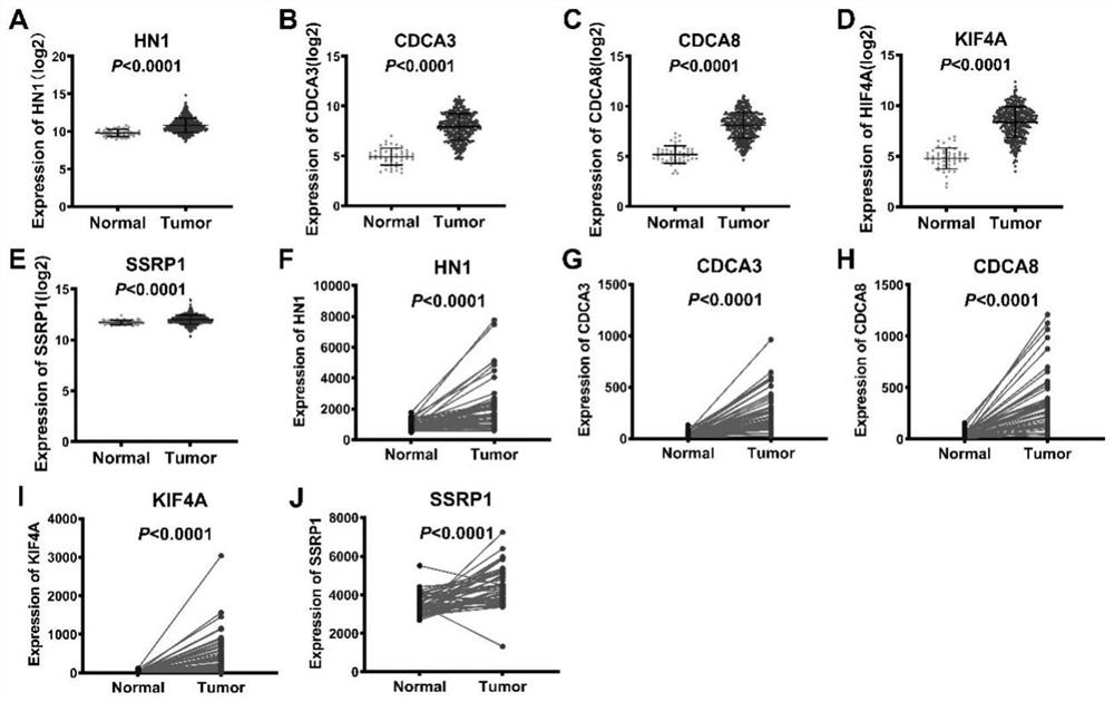 Combined marker for predicting prognosis of liver cancer and application of combined marker