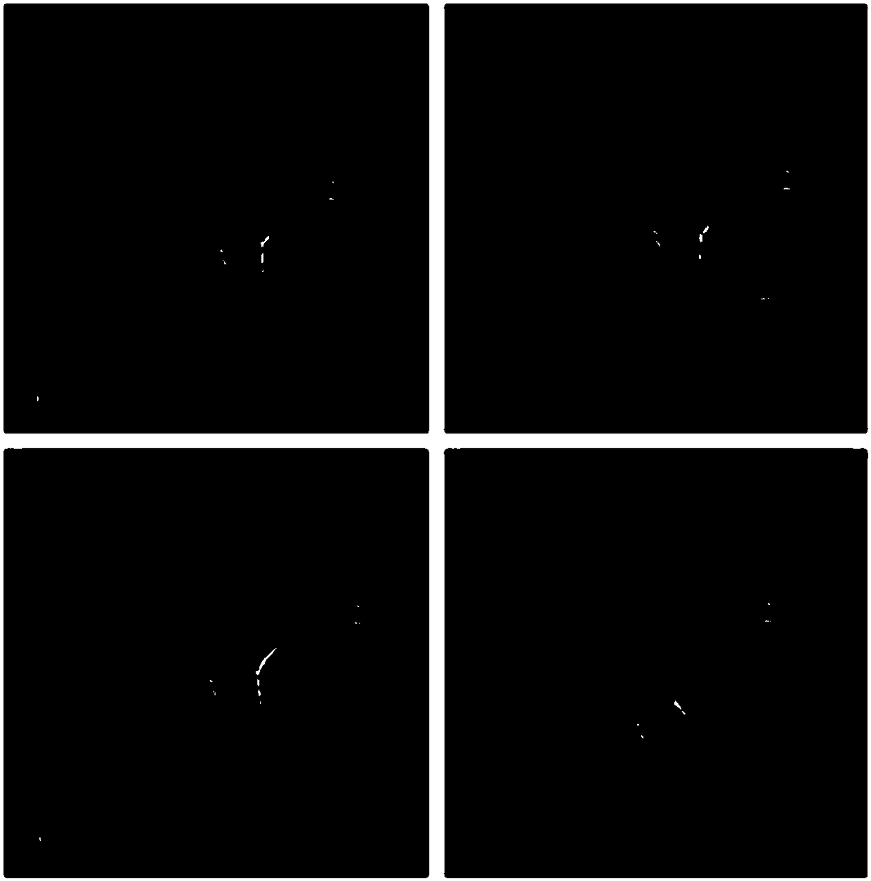 Tetrandrine liquid crystal nanoparticle ophthalmic preparation and preparation method thereof