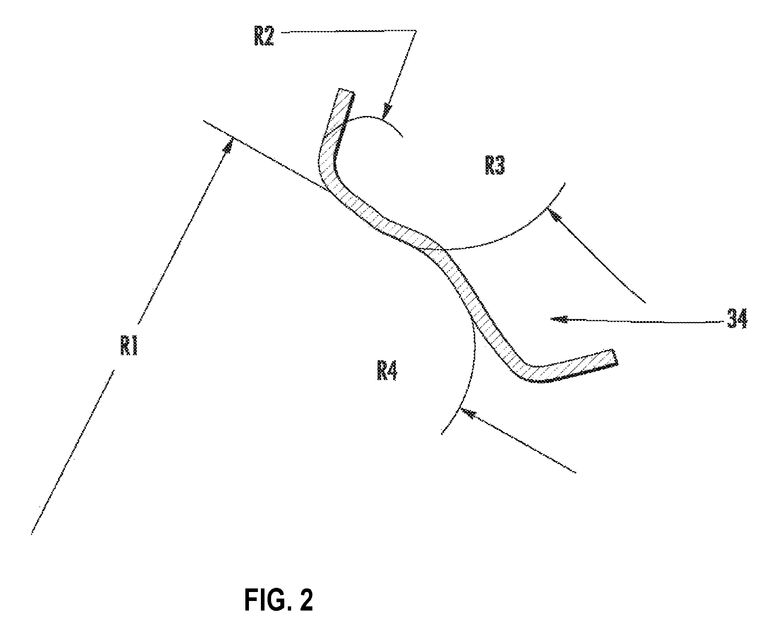 Prosthetic ball-and-socket joint