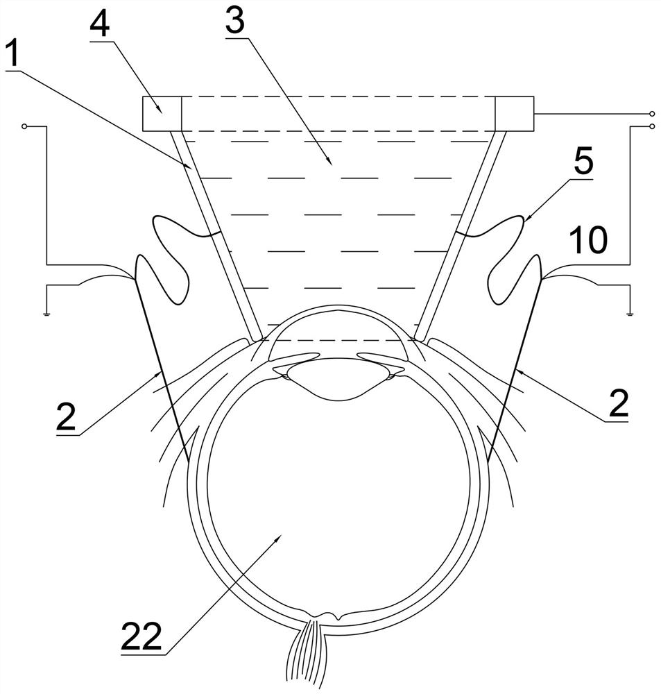 A microneedle device for retinal veins