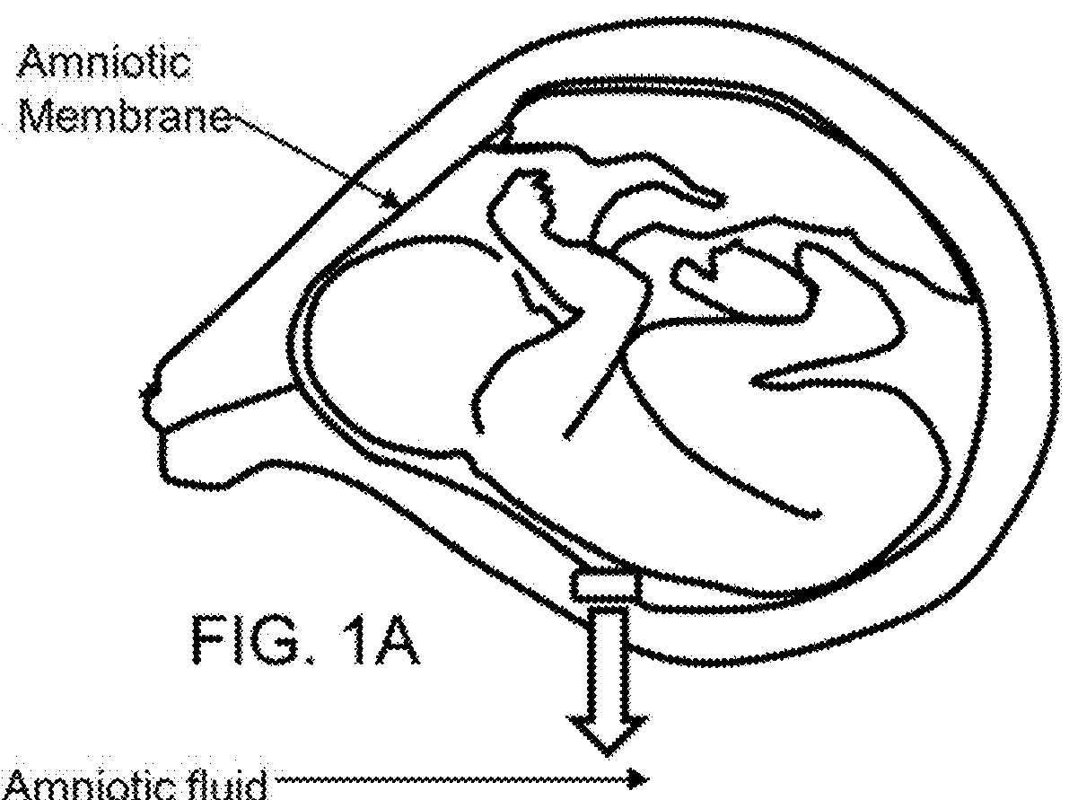 Amnion derived therapeutic composition and process of making same