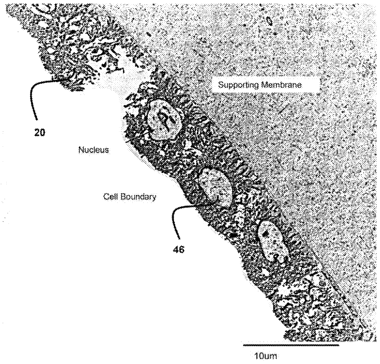 Amnion derived therapeutic composition and process of making same