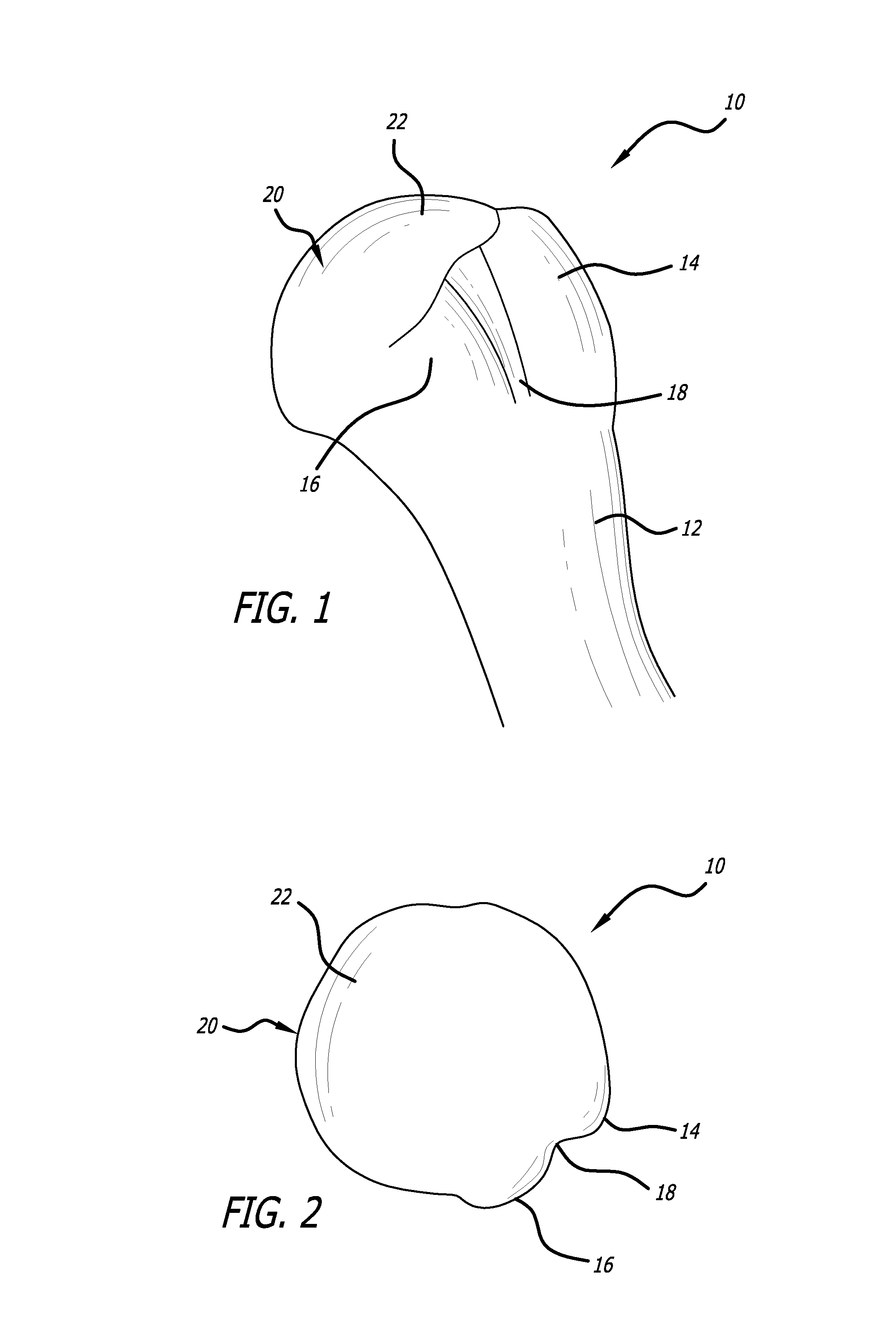 Anterior lesser tuberosity fixed angle fixation device and method of use associated therewith