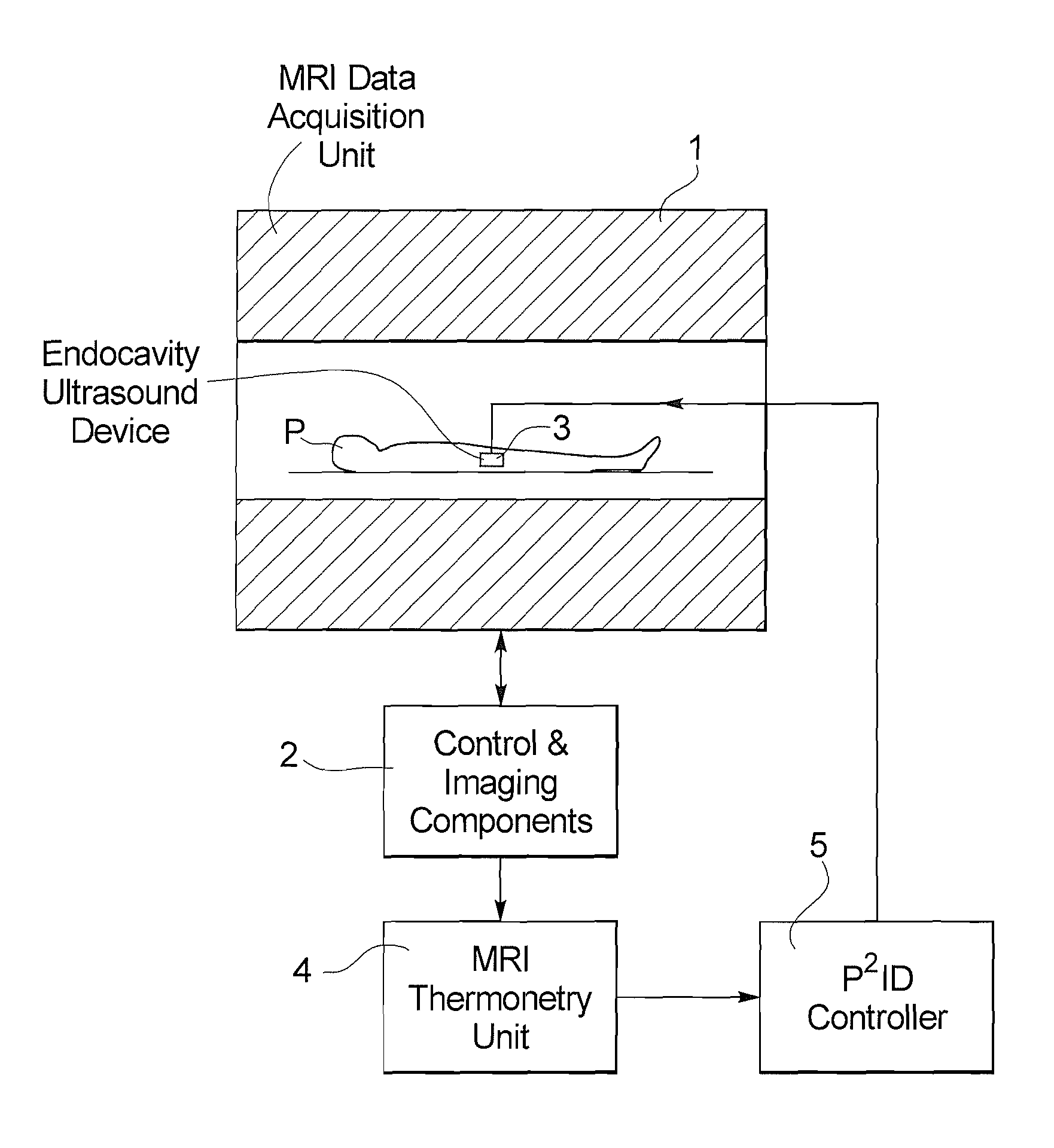 Method for temperature control in magnetic resonance-guided volumetric ultrasound therapy