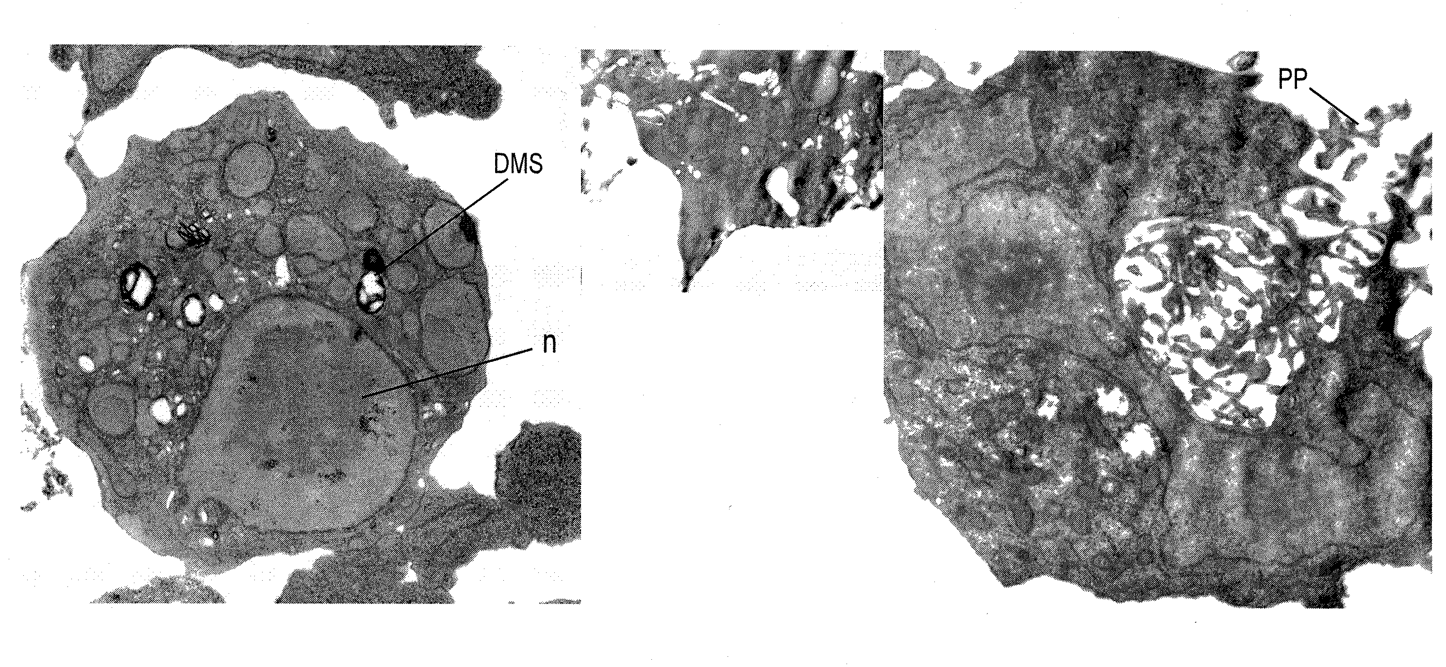 Control of malignant cells by kinase inhibition