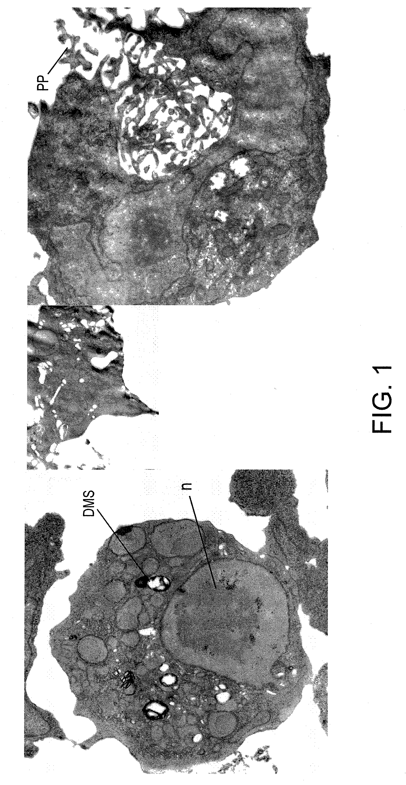 Control of malignant cells by kinase inhibition