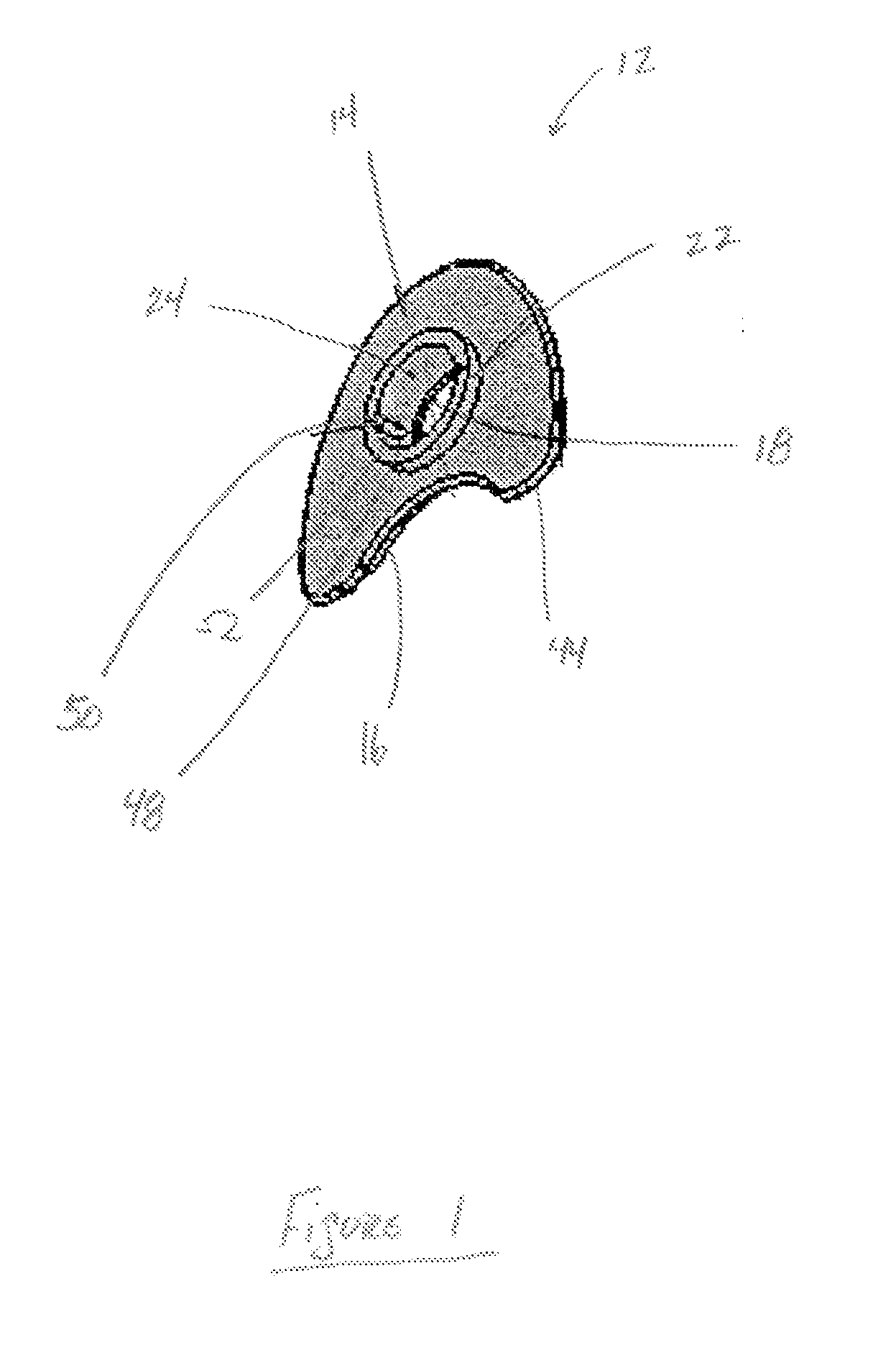 Occlusal device and method of use thereof for diagnostic evaluation of maxillomandibular relationships in edentulous patients