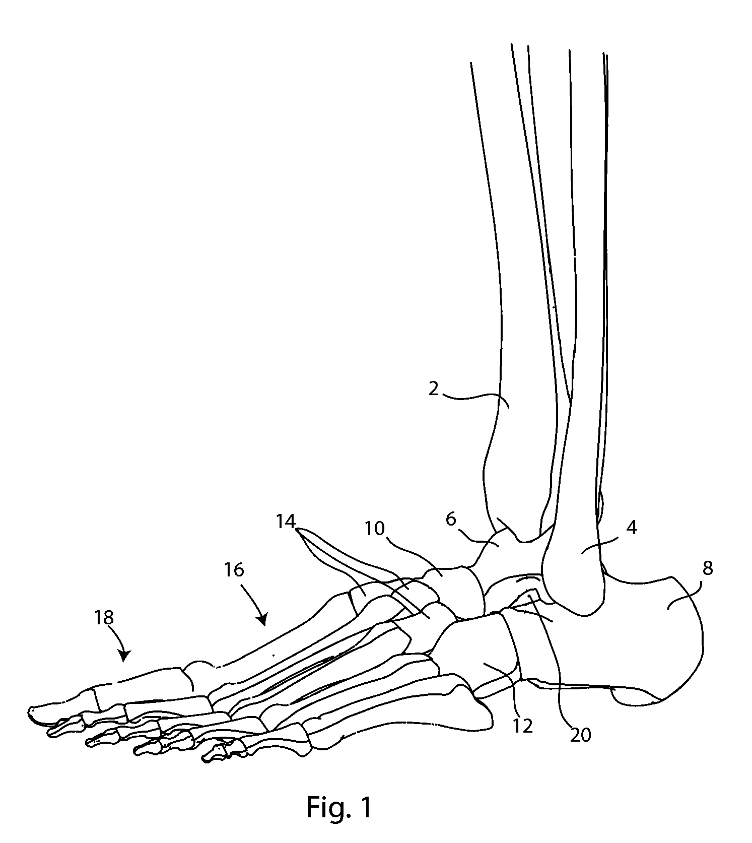 Joint Arthrodesis and Arthroplasty