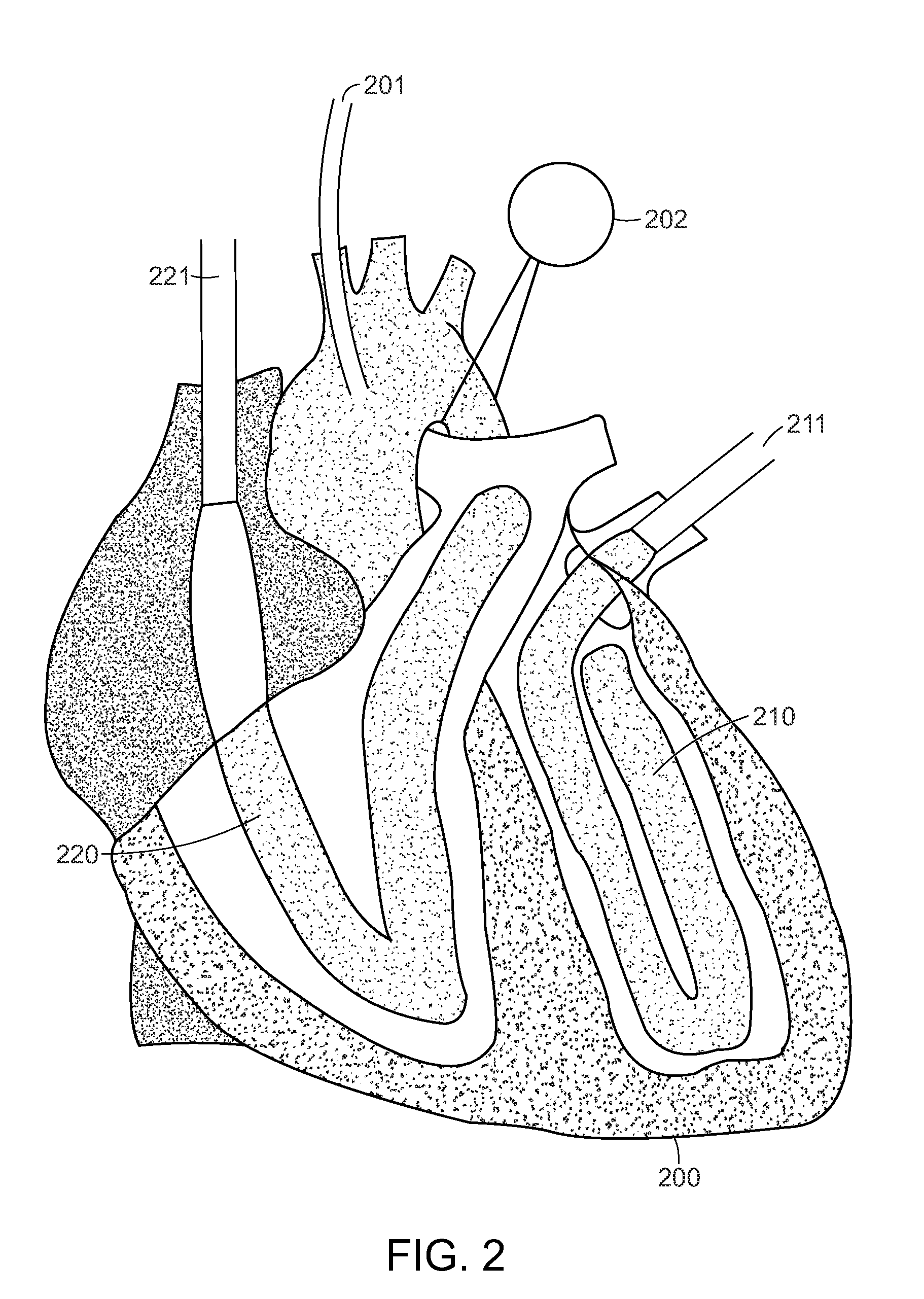 Computer-controlled tissue-based simulator for training in cardiac surgical techniques