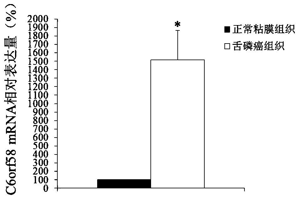 Application of c6orf58 gene in preparation of diagnosis and treatment products for tongue squamous cell carcinoma