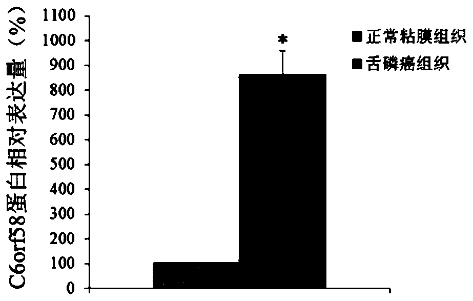 Application of c6orf58 gene in preparation of diagnosis and treatment products for tongue squamous cell carcinoma