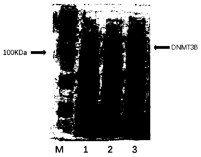 Efficient culture medium for expressing soluble recombinant protein by escherichia coli and preparation method of culture medium