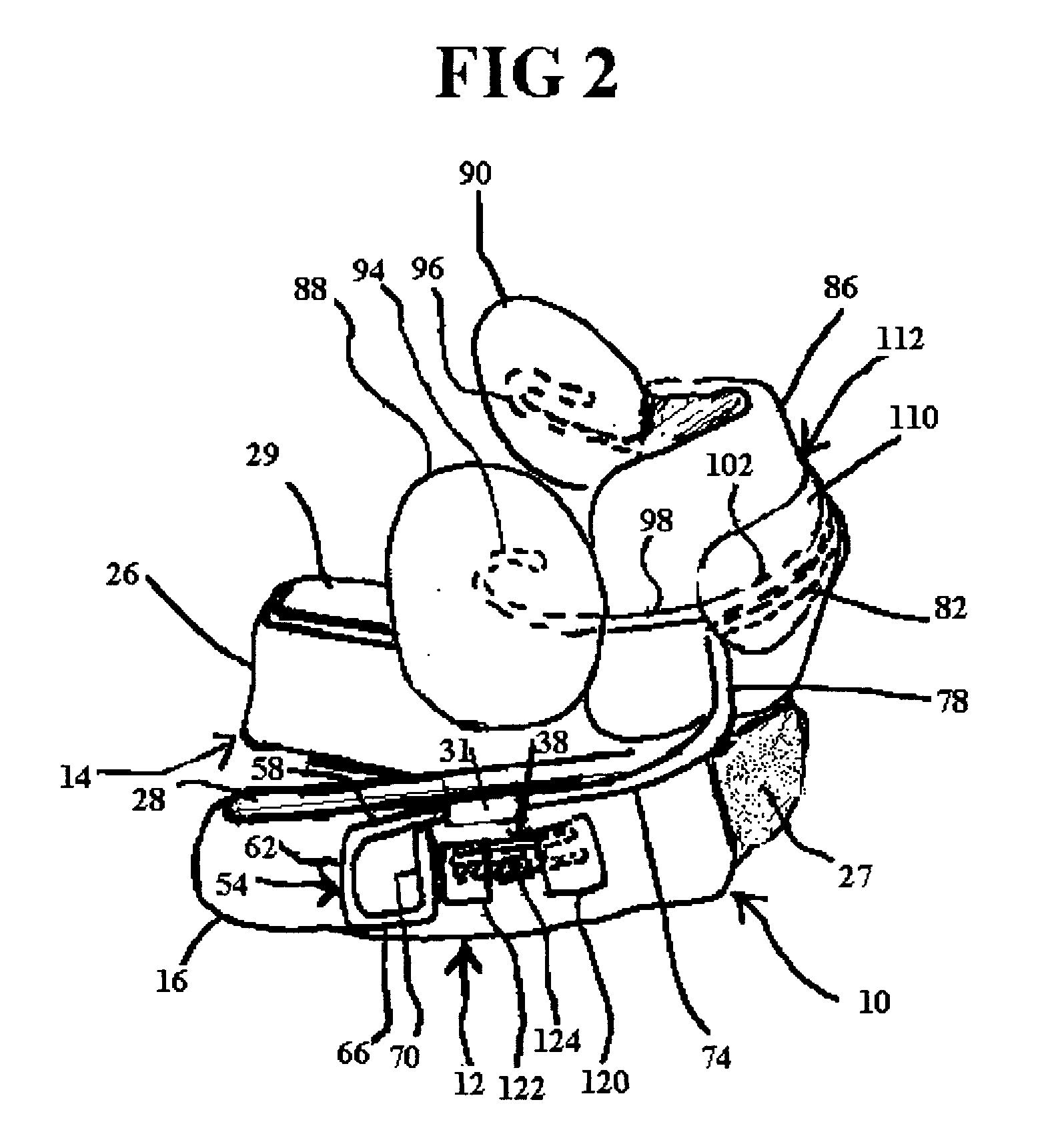 Dental appliance for improving airflow through nasal-pharyngeal airway