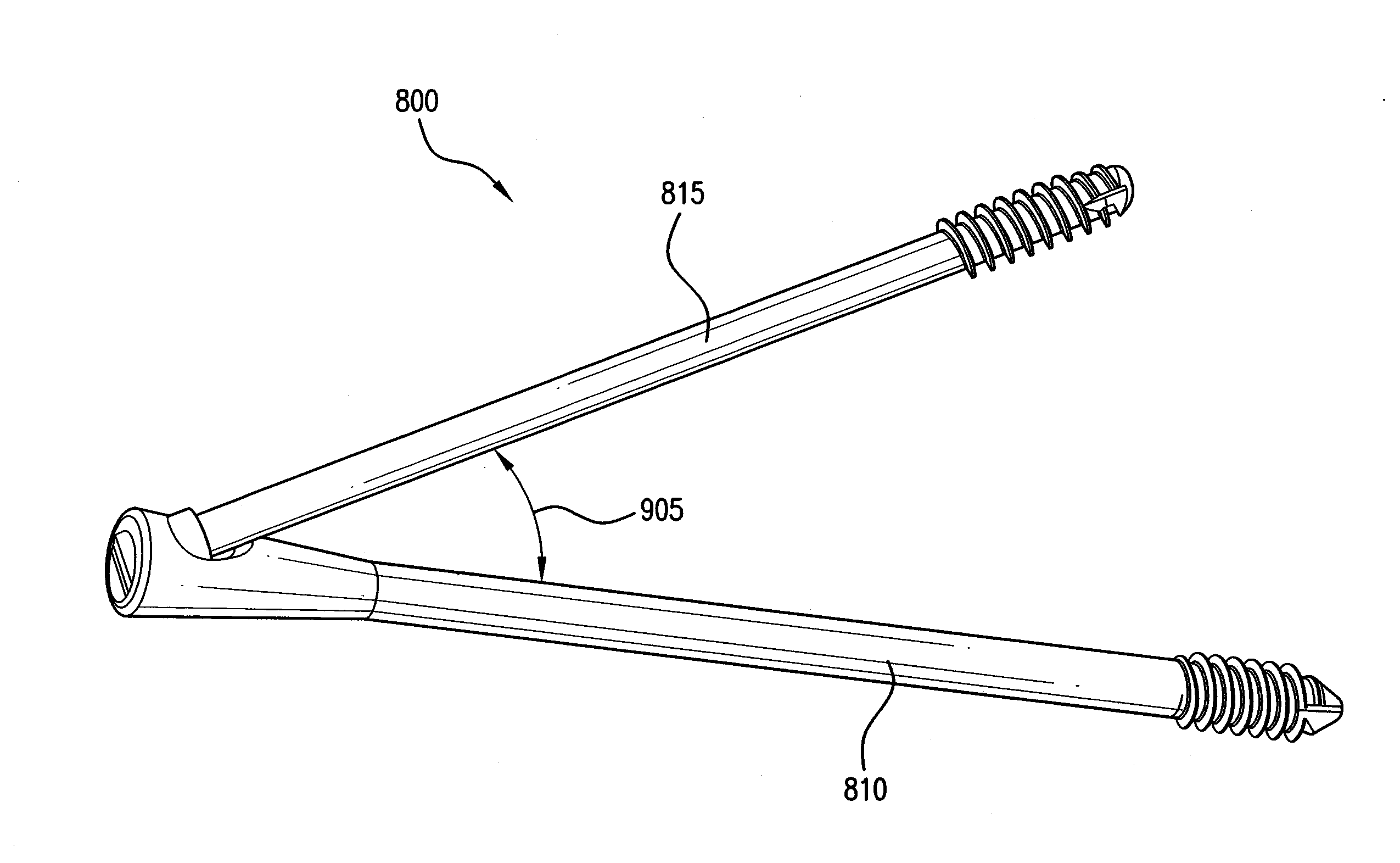 Intramedullary Fixation Assembly and Method of Use