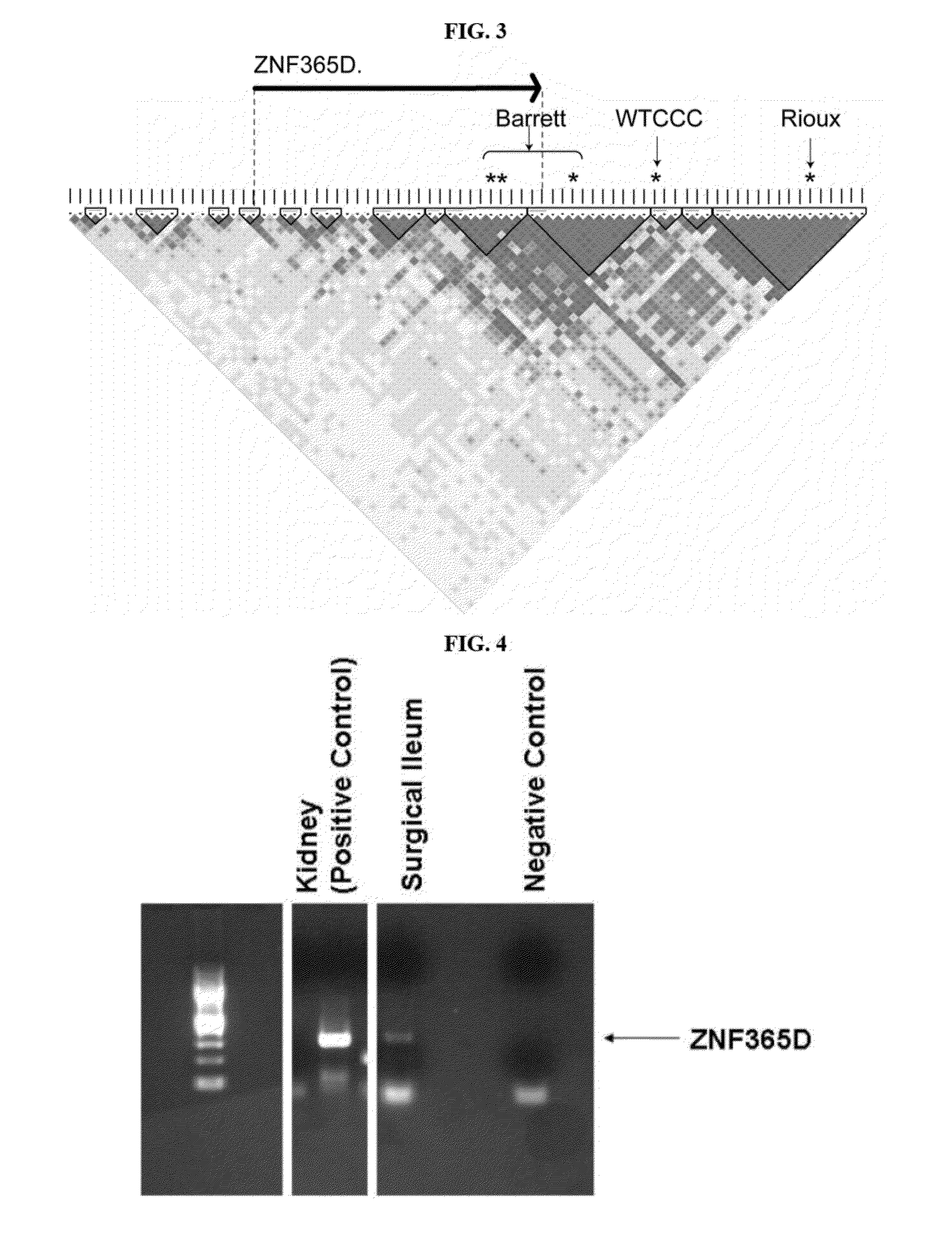 Methods of diagnosing and treating inflammatory bowel disease