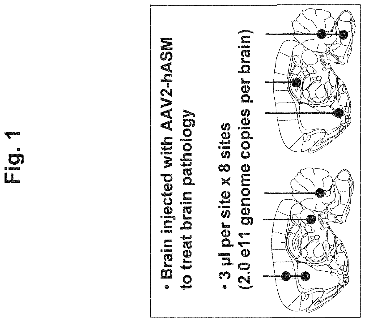 Gene therapy for niemann-pick disease type a