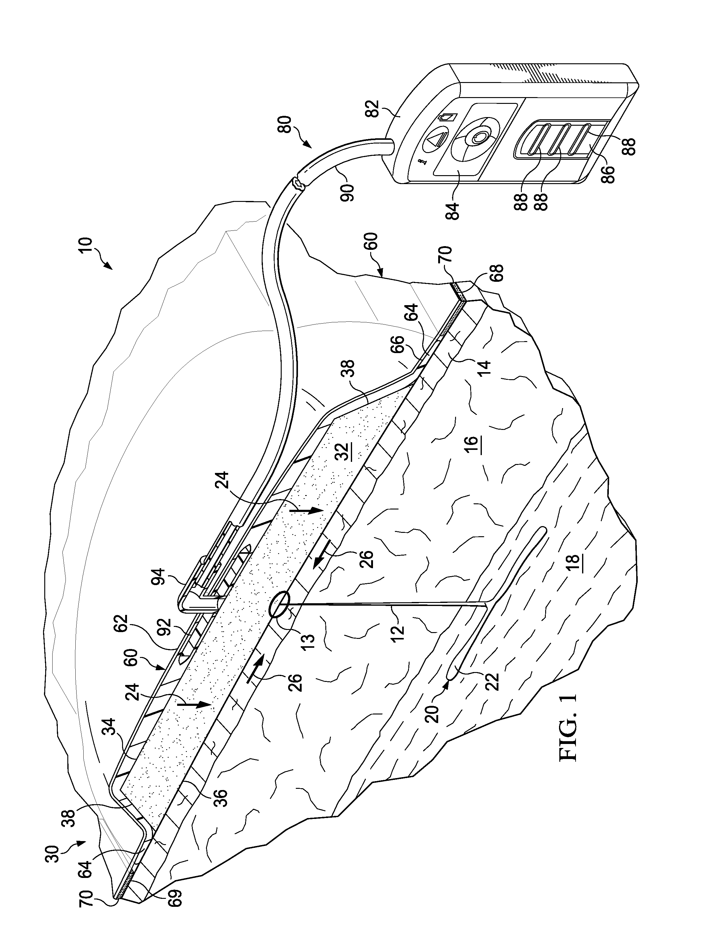 Dressing assemblies for wound treatment using reduced pressure