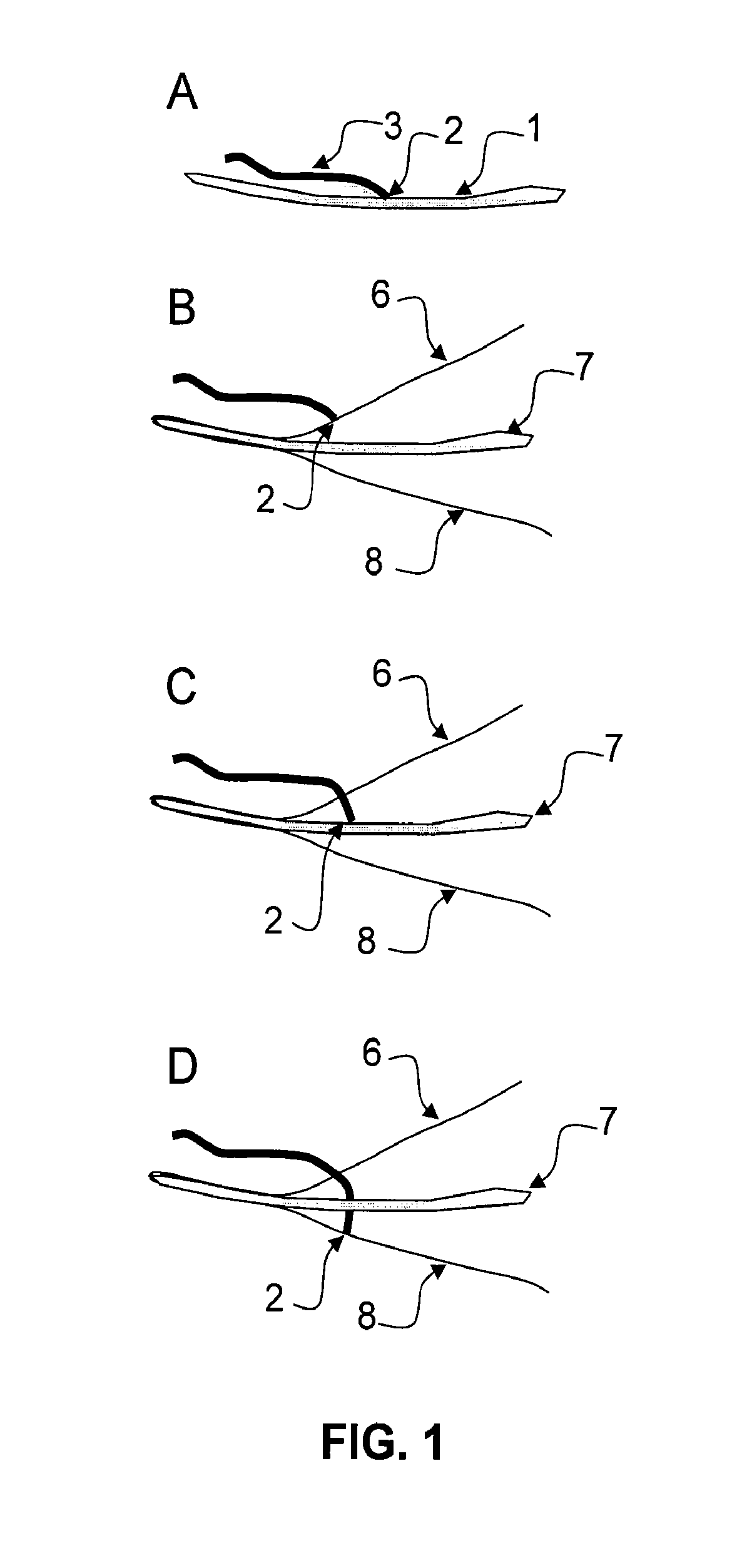 Sanitary Napkin with Braid