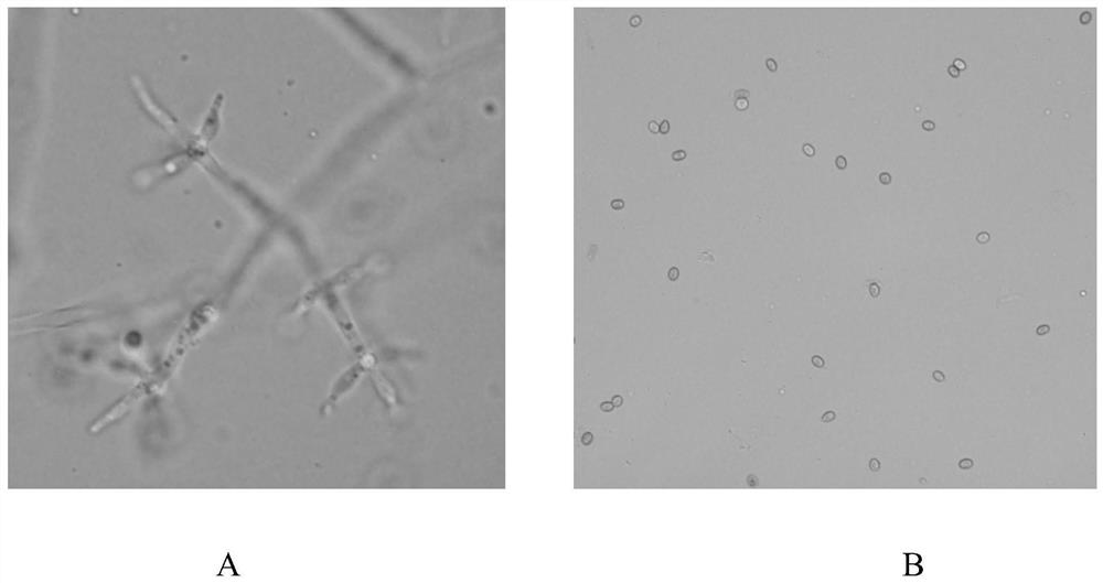 Trichoderma koningiopsis and application thereof in prevention and treatment of litchi anthracnose