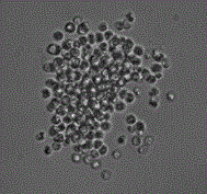 Genetic transformation method of PEG/LiAc mediated plasmodiophora brassicae woronin