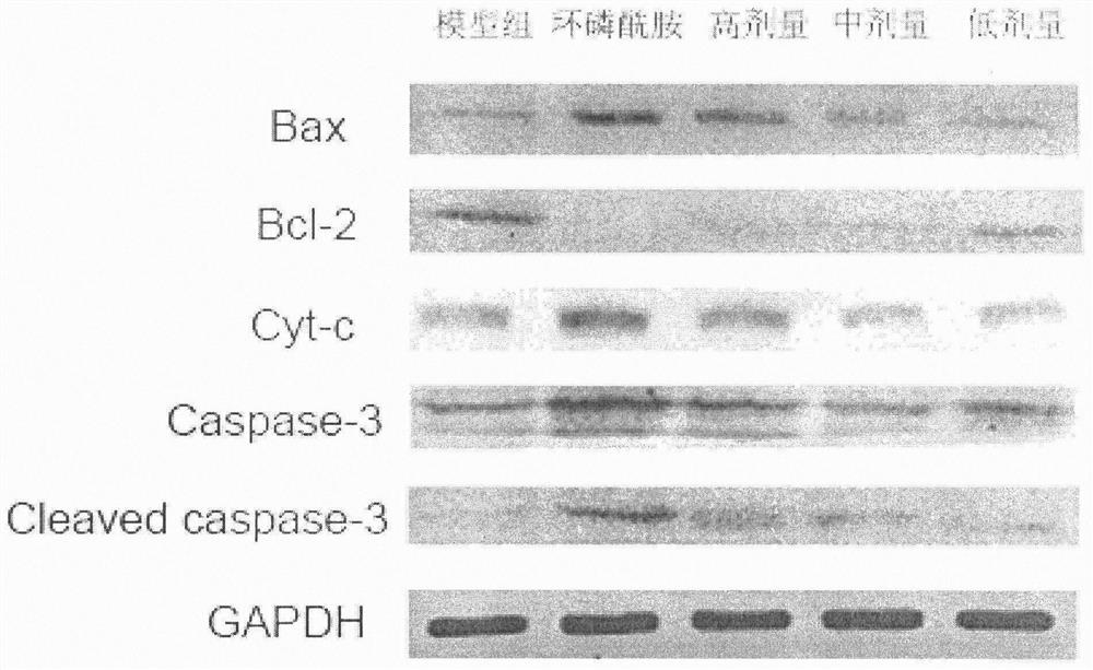 A traditional Chinese medicine composition for treating liver cancer and liver cirrhosis