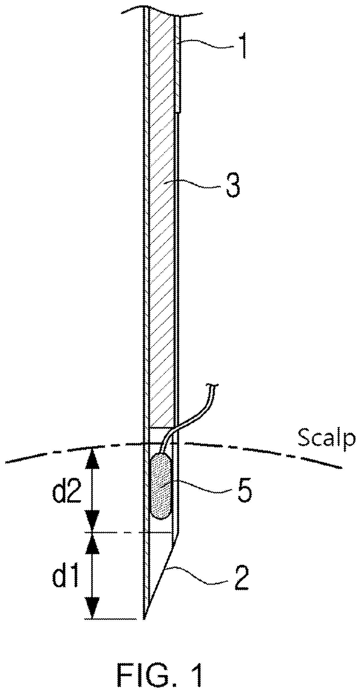 Hair transplanter having core shaft conveying portion