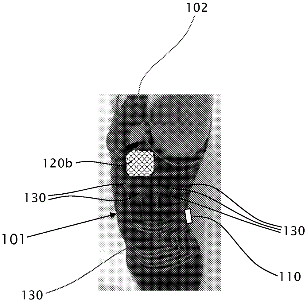 Independent wearable health monitoring system adapted to interface with a treatment device