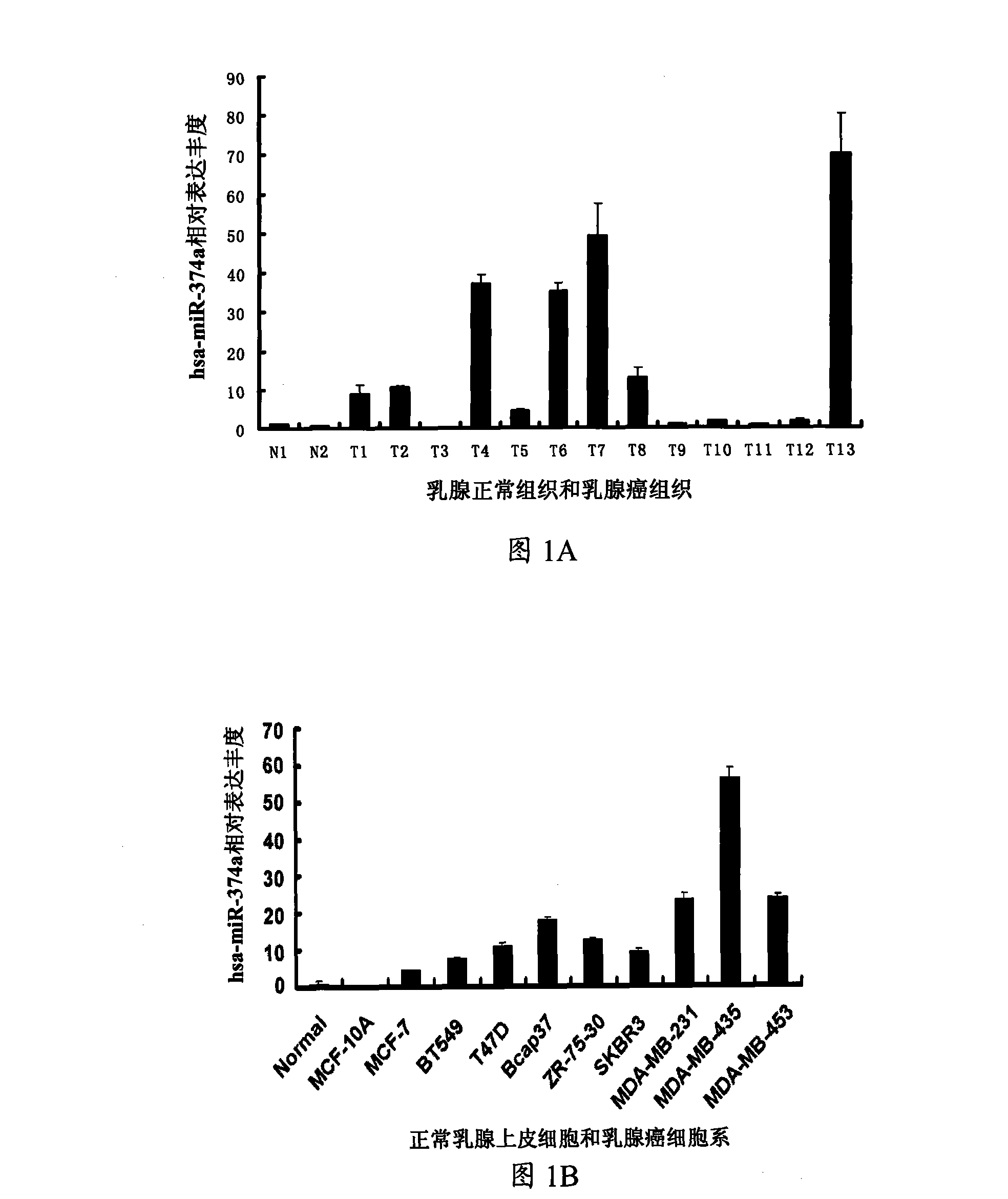 Molecular marker hsa-miR-374a of breast carcinoma and application thereof