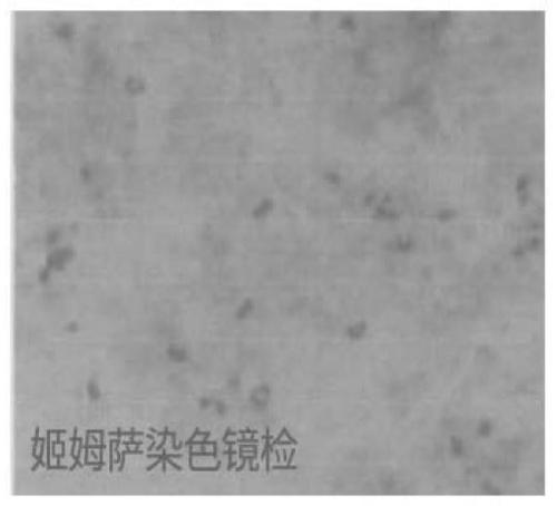 Culture medium and fermentation culture method used for high-density culture of mycoplasma capricolumsubsp. capripneumonia